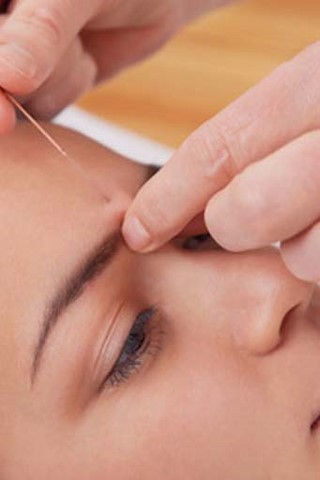 Acupuncture