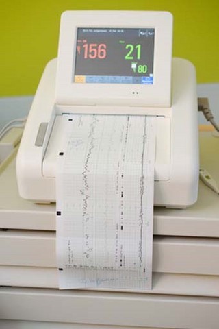enregistrement du rythme cardiaque fœtal